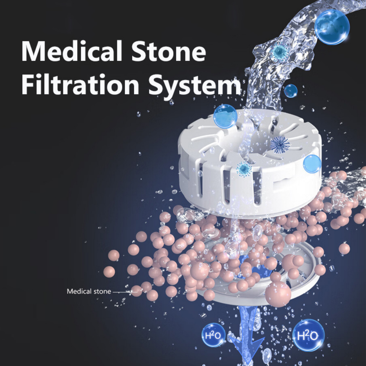 medical stone filtration system
